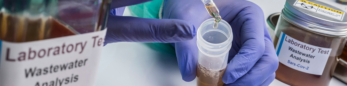 Cell-Free DNA tubes Cell-Free DNA tubes