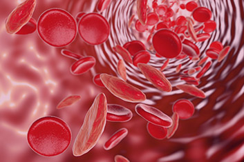sickle cell anemia illustration