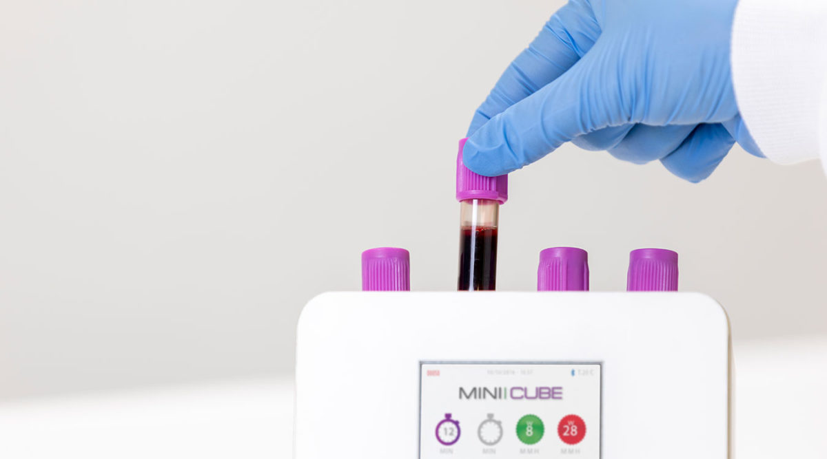 Diesse MINI-CUBE automated erythrocyte sedimentation rate (ESR) analyzer