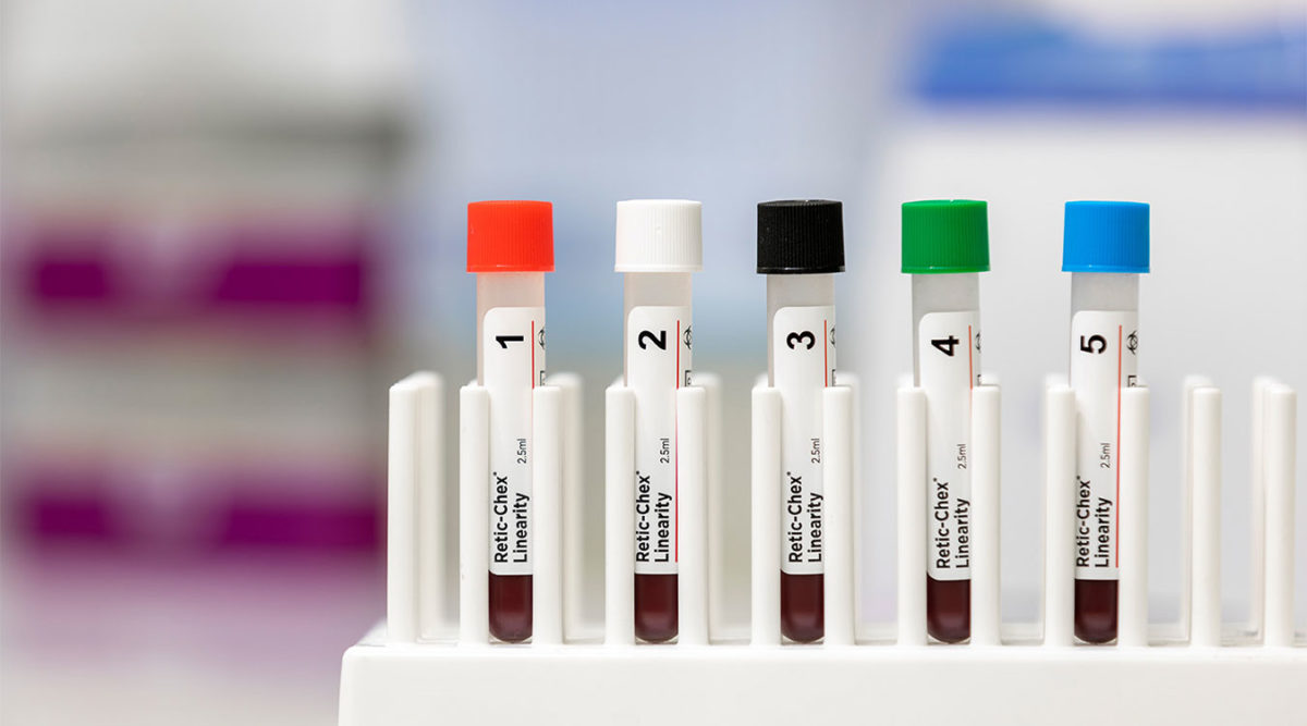 Retic-Chex Linearity control kit on lab bench