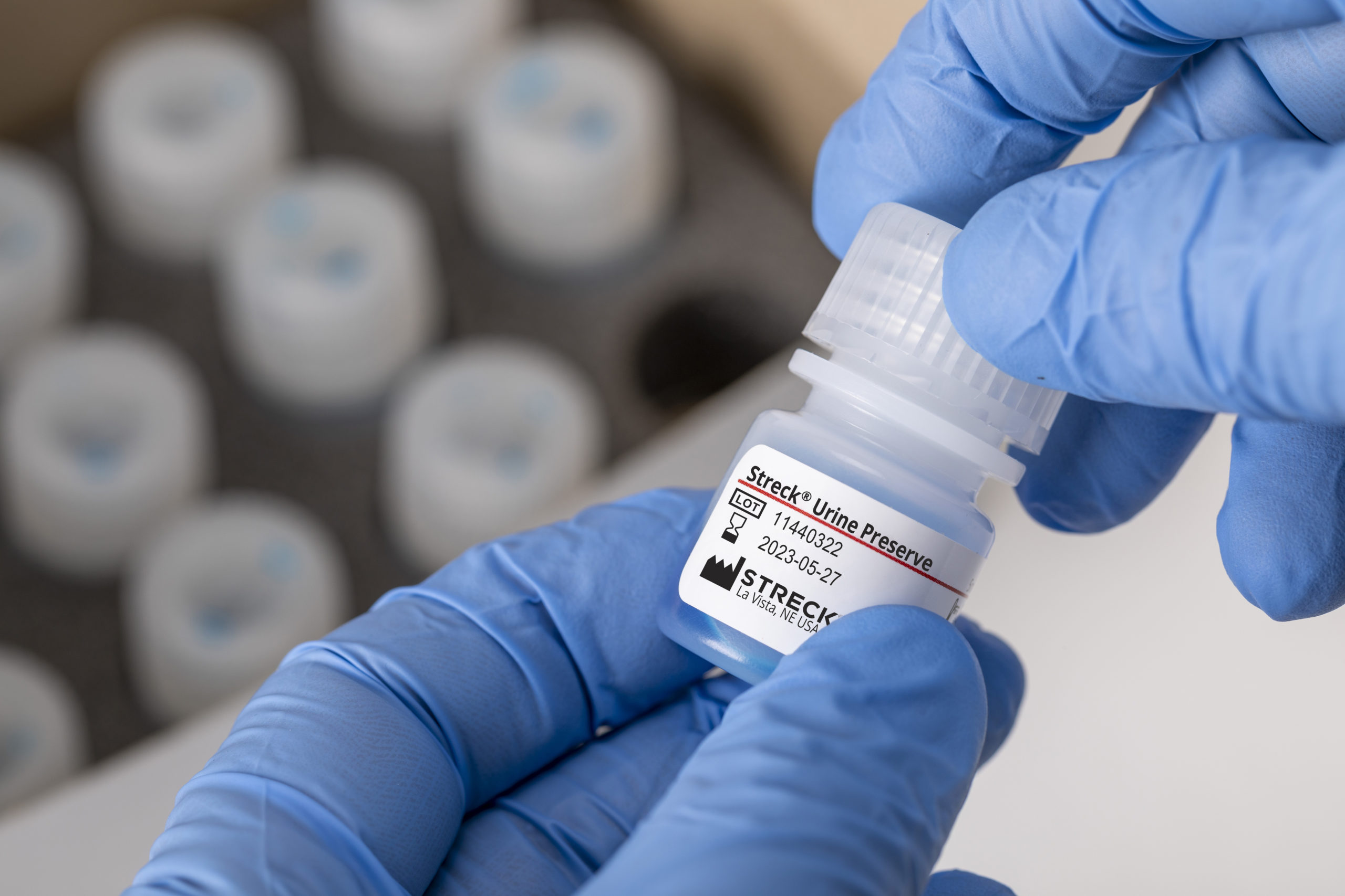 Streck Urine Preserve vial