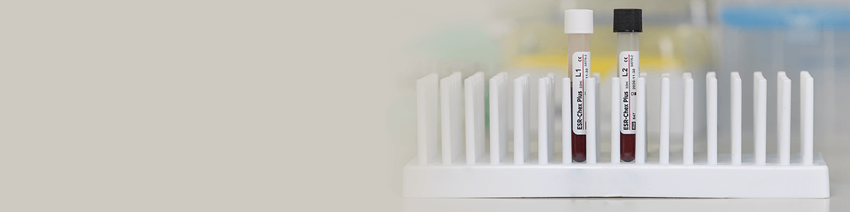 Cell-Free DNA tubes